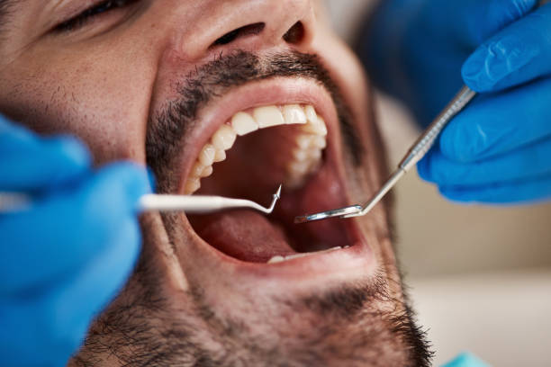 Best Emergency Gum Pain Relief  in Maplewood, MN